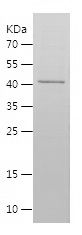    LONP1 / Recombinant Human LONP1