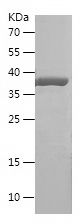    NEFH / Recombinant Human NEFH