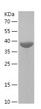    STAU1 / Recombinant Human STAU1