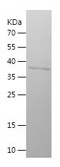    IFT88 / Recombinant Human IFT88