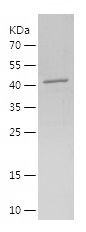    AGTPBP1 / Recombinant Human AGTPBP1