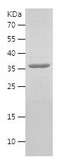    MT-CO2 / Recombinant Human MT-CO2