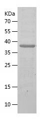    ACSL4 / Recombinant Human ACSL4