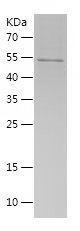    CHEK2 / Recombinant Human CHEK2