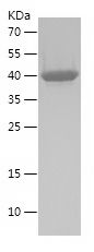    TRIM44 / Recombinant Human TRIM44