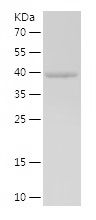    SUCLA2 / Recombinant Human SUCLA2