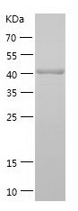    PADI4 / Recombinant Human PADI4