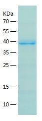    ATR / Recombinant Human ATR