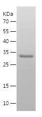    HNRNPK / Recombinant Human HNRNPK