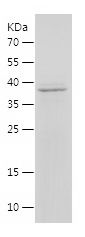    DHRS3 / Recombinant Human DHRS3