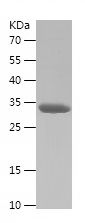    CCP110 / Recombinant Human CCP110