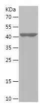    LIG4 / Recombinant Human LIG4