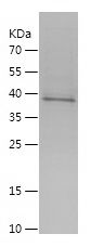    SNAI2 / Recombinant Human SNAI2