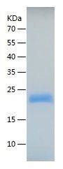 Recombinant Mouse Timp2