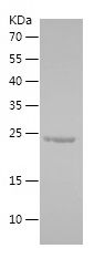    RAB35 / Recombinant Human RAB35