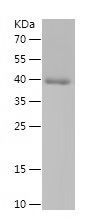    NDUFS1 / Recombinant Human NDUFS1