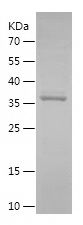    TPI1 / Recombinant Human TPI1