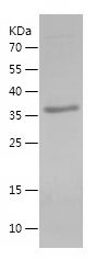    CCND2 / Recombinant Human CCND2