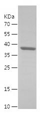    TXNRD1 / Recombinant Human TXNRD1