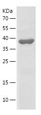    NUSAP1 / Recombinant Human NUSAP1