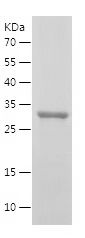    MT-ATP6 / Recombinant Human MT-ATP6