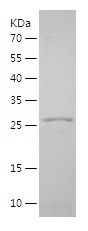    MPV17 / Recombinant Human MPV17