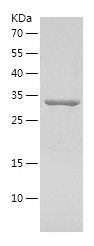    SLC29A1 / Recombinant Human SLC29A1