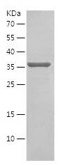    SSR2 / Recombinant Human SSR2