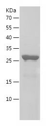    MTCYB / Recombinant Human MTCYB