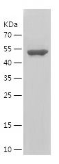    OXCT1 / Recombinant Human OXCT1