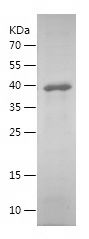    CASP7 / Recombinant Human CASP7