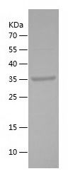    STMN2 / Recombinant Human STMN2