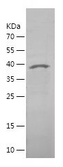    MOV10 / Recombinant Human MOV10