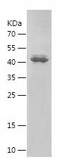    HSD17B2 / Recombinant Human HSD17B2