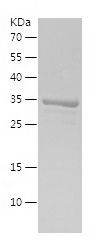    S1PR2 / Recombinant Human S1PR2