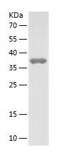    LMNB2 / Recombinant Human LMNB2