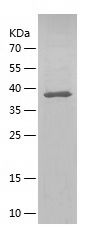    SQOR / Recombinant Human SQOR