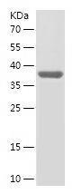    ALKBH5 / Recombinant Human ALKBH5