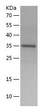    STUB1 / Recombinant Human STUB1