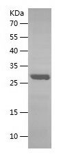    MTND1 / Recombinant Human MTND1