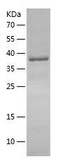    DEK / Recombinant Human DEK