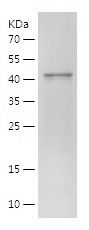    GOLGA2 / Recombinant Human GOLGA2