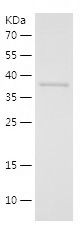    NDE1 / Recombinant Human NDE1