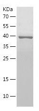    PAX6 / Recombinant Human PAX6