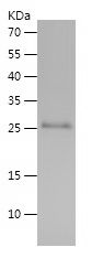    TIMP1 / Recombinant Human TIMP1