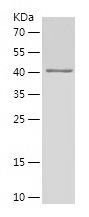    DVL2 / Recombinant Human DVL2