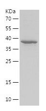    PEX16 / Recombinant Human PEX16