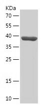    HEY2 / Recombinant Human HEY2