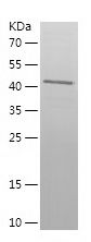    CEP250 / Recombinant Human CEP250