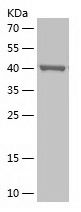    PLIN3 / Recombinant Human PLIN3